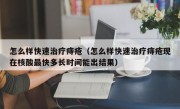 怎么样快速治疗痔疮（怎么样快速治疗痔疮现在核酸最快多长时间能出结果）