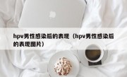 hpv男性感染后的表现（hpv男性感染后的表现图片）