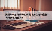 男性hpv感染有什么表现（女性hpv感染有什么表现图片）