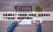 耳垂里面长了个硬疙瘩一捏就疼（耳垂里面长了个硬疙瘩一捏就疼严重吗）